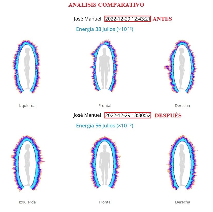 comparación antes y después de energía 